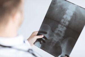 Herniated disc from work tasks claims guide